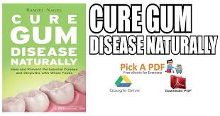 Cure Gum Disease Naturally Pdf Free Download Direct Link