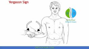 Image result for Yergason Test