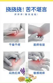 挠挠挠 苦不堪言 痒痒痒 整夜辗转难眠 干燥干痒 剧痒收敛 闷热红痒 敏感刺痒 agigi 安全有效 瘙痒 抗菌 蚊虫叮咬 淤青