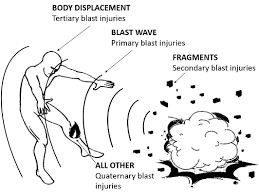 One is an explosive shock of electric energy while the other is an explosive wave of sound. The Physics Of The Fireball Dump Stat Adventures