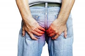 Image result for itchy skin rectum