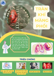 Bệnh tràn khí màng phổi - Bệnh viện Đa khoa tỉnh Thái Bình