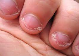 Trucs De Grand Mere Pour Ne Plus Se Ronger Les Ongles Astuces De Grand Mere