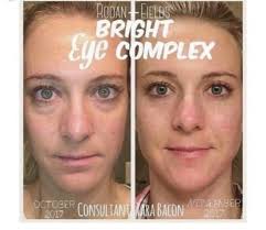 Rodan+Fields with Rowie...