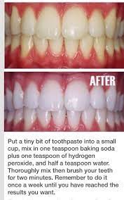 Pin On Natural Health Care Remedies