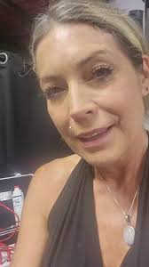 Morgellons Face Treatment