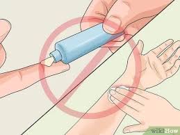 We did not find results for: How To Take The Sting Out Of A Burn With Pictures Wikihow