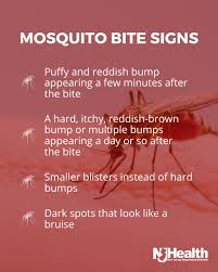 Image result for mosquito bite