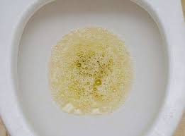 Check spelling or type a new query. When Going To The Toilet The Urine Is Foamy Is It Proteinuria And Renal Insufficiency Don T Be Foolish Inews