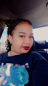 Please help my scalp started turning grey and it itches terribly I don't  know what it is and how to get rid of it