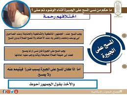 حكم نسيان المسح على الجبيرة أثناء الوضوء البحوث الإسلامية توضح بوابة أخبار اليوم الإلكترونية