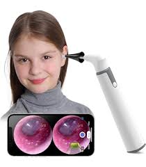 Amazon.com: Jiusion 3.9mm Ultra-Thin Portable USB Digital Otoscope Camera  with Carrying Case, HD 720P 6 LED Visual Ear Scope with 3 Hats 2 Silicone  Caps 8 Earwax Spoons for Android Windows Mac