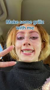 Step 1 (dental impression)