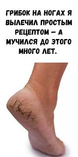 как быстро избавиться от лишнего веса в домашних условиях Pin On Kak Bystro Pohudet