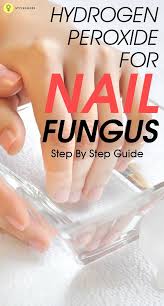 Do You Have Nail Fungus Are You Looking For A Home Remedy To Treat It What You Need Is Hydrogen P Toenail Fungus Remedies Nail Fungus Cure Nail Fungus Remedy