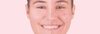 Centre Laser Esthétique Conti L'Isle-Adam