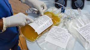 Image result for Plasma Transfusion