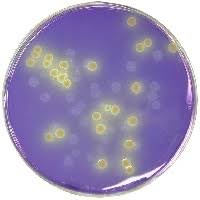 Image result for Clostridium