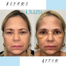 Dr. Jan Paul Ulloa Padilla Ophthalmic Plastic and Reconstructive Surgery  Aceptamos los siguientes planes médicos: