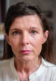 Mother's selfie reveals pain she suffered at hands of her boyfriend