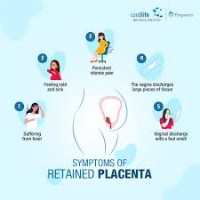 Image result for Retained Placenta