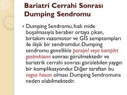 .bu sendromda mide bulantısı, karın krampı, şişkinlik, soğuk terleme gibi belirtiler görülebiliyor. Bariatrik Cerrahi Dumping Sendromu Ile Iliskisi Gorh Ile Iliskisi Ppt Video Online Indir