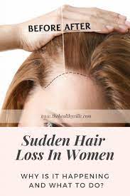 Hair strands are made mostly from proteins. Sudden Hair Loss In Women Why Is It Happening And What To Do Sudden Hair Loss Anti Hair Loss Hair Loss Women