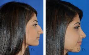 Pin On Plastic Surgery