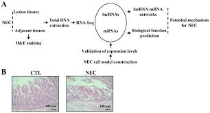 She developed a fatal gastrointestinal disease common in premature babies called necrotizing enterocolitis, and she died at the age of 2 months. Integrated Analysis Of A Lncrna Mrna Network Reveals A Potential Mechanism Underlying Necrotizing Enterocolitis