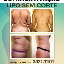 ), is a portuguese retired professional footballer who played as a central midfielder. Photos A Centro De Estetica Josy Oliveira Mondubim 9 Conseils De 25 Visiteurs