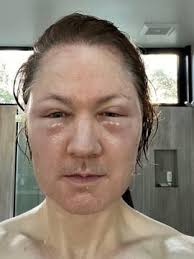 Demi Lovato slaví 30. Z dětské hvězdy je inspirativní osobnost