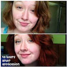 Before And After Henna Red Wine By The Henna Guys Bought On Amazon Henna Hair Henna Hair Dye Before And After Henna Red Hair