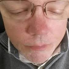 Johnny Brewer (brew2322@)