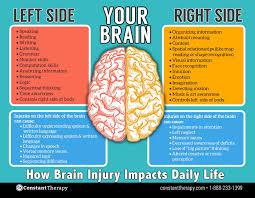 Have You Ever Heard People Say That They Tend To Be More Of A Right Brain Or Left Brain Thin In 2020 Brain Injury Awareness Brain Injury Recovery Tramatic Brain Injury