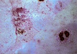 Image result for Rhizobium radiobacter, syn. Agrobacterium tumefaciens