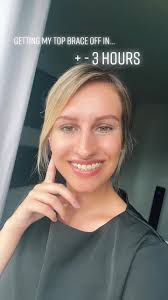 Exciting Countdown to Removing My Adult Ceramic Braces