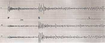 A seismometer is an instrument that responds to ground noises and shaking such as caused by earthquakes, volcanic eruptions, and explosions.they are usually combined with a timing device and a recording device to form a seismograph. Sismographe Larousse