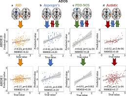 What do you know about asperger syndrome? Common And Unique Multimodal Covarying Patterns In Autism Spectrum Disorder Subtypes Molecular Autism Full Text