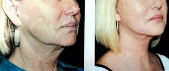 Linda Potash's Instagram, Twitter & Facebook