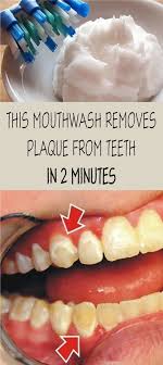 This Mouthwash Removes Plaque From Teeth In 2 Minutes Oral Care Natural Oral Care Healthy Teeth