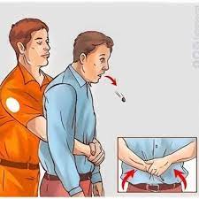 Heimlich manevrası, halk arasında hemlik manevrası olarak da bilinen önemli bir ilkyardım uygulamasıdır. Heimlich Manevrasi Nedir Heimlich Manevrasi Nasil Uygulanir