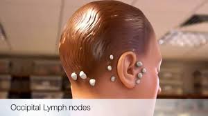 When enlarged, they can be located anywhere form the middle of your hairline at the back to behind your ears. Medical Freaks Facebook