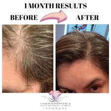 Scientists and specialists determined how castor oil improved or enhanced the quality of hair. Jamaican Black Castor Papaya Strengthen Seal Restore Growth Oi Unforgettable Treasure Llc