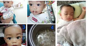 Jika anda tak nak gunakan perubatan moden, kami syorkan anda cuba beberapa rawatan tradisional sebagai petua hilangkan batuk bayi anda. Teknik Stim Tepukan Percussion Bantu Keluarkan Hingus Pekat Anak Legakan Batuk Dan Selesema Pa Ma