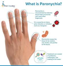 Image result for paronychium