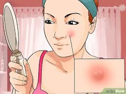 Di tengah2 area bulu dada. Cara Memecahkan Bisul 7 Langkah Dengan Gambar Wikihow