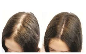 So, the more of that you have, the the more likelihood of your skin growth, hair growth, nail growth, all that. Biotin Hair Growth Before And After Pictures