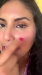 Rejuvenecimiento facial con Exosomas ✨