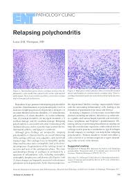 Image result for Relapsing Polychondritis