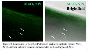 This review focusses on the green synthesis, applications and future. Manganese Dioxide Nanoparticles Mitigate Oxidative Stress In Osteoarthritic Cartilage Osteoarthritis And Cartilage